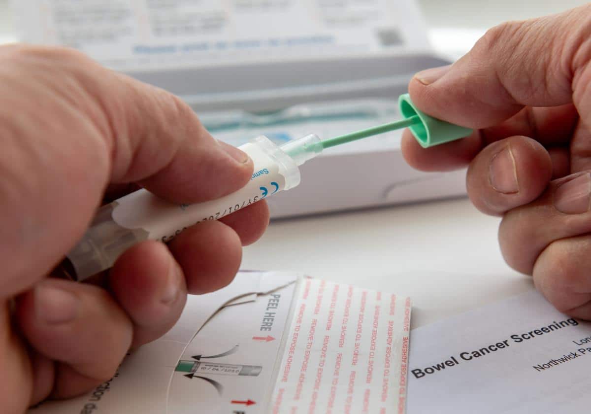 Así es la prueba para detectar el cáncer colorrectal que salva vidas
