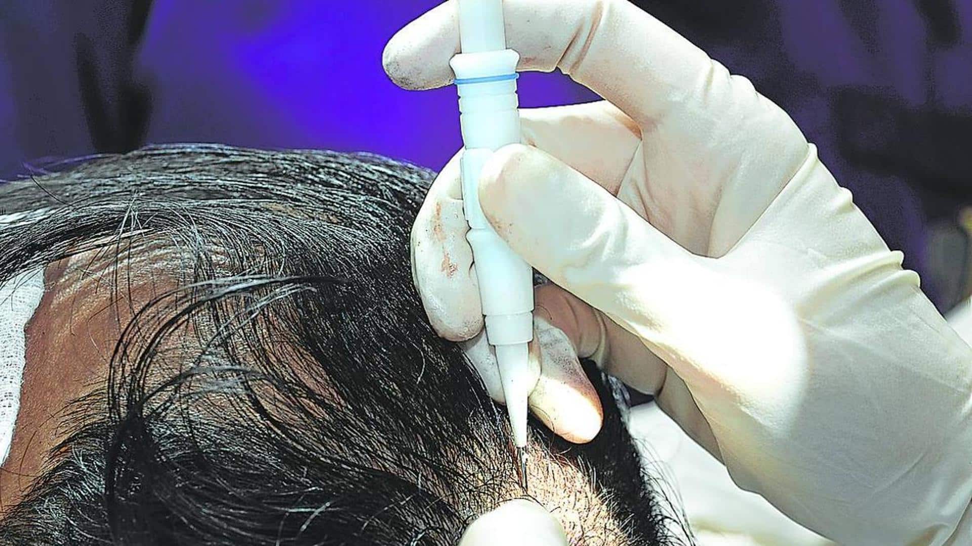 La familia del fallecido tras un implante capilar en Bilbao no será indemnizada