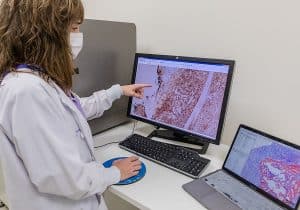 El cáncer de recto aumenta con una mortalidad mayor entre las personas con 20 y 44 años