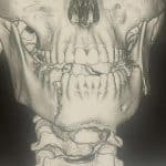 Un menor de 14 años, hospitalizado tras una grave agresión en un instituto de Fuengirola