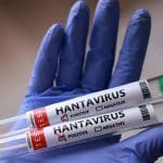 La mortalidad de este brote de hantavirus es del 38%, según la OMS