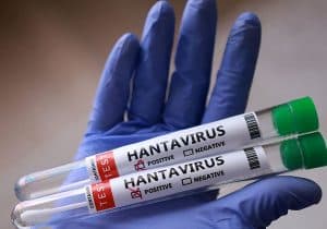 La mortalidad de este brote de hantavirus es del 38%, según la OMS